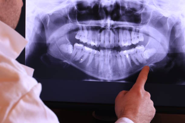 Best Broken or Chipped Tooth Repair in Glasgow Village, MO